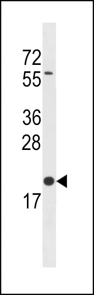 BLOC1S3 Antibody