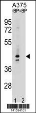 OR5AC2 Antibody