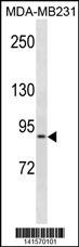 KIRREL Antibody