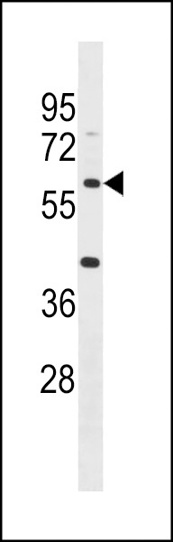 ACSM4 Antibody