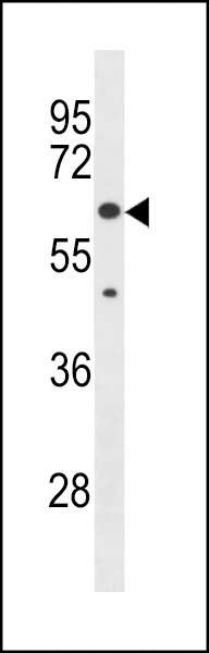 KLHL30 Antibody
