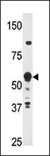ZNF395 Antibody