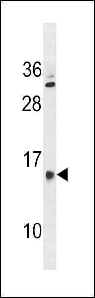 GALNTL5 Antibody