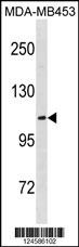ENPP3 Antibody