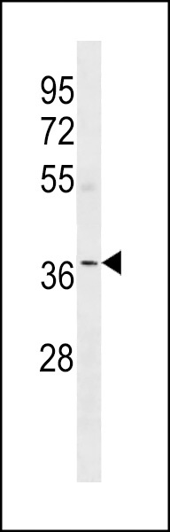 OR5W2 Antibody