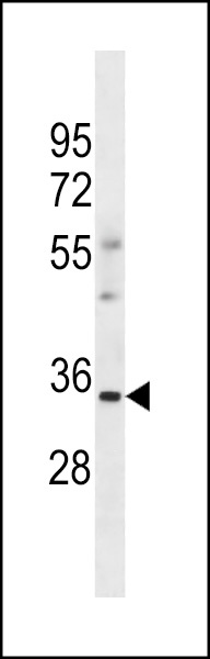 OR6S1 Antibody
