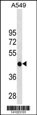 GATM Antibody