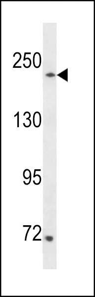 SETD1A Antibody