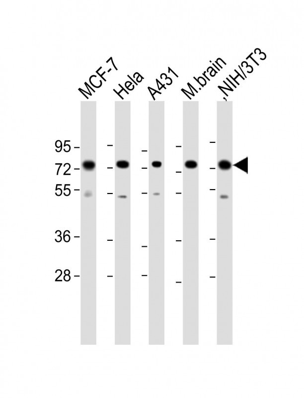MTA1 Antibody