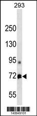MTA1 Antibody