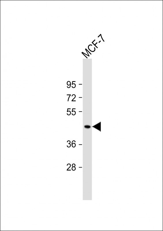 MBOAT7 Antibody