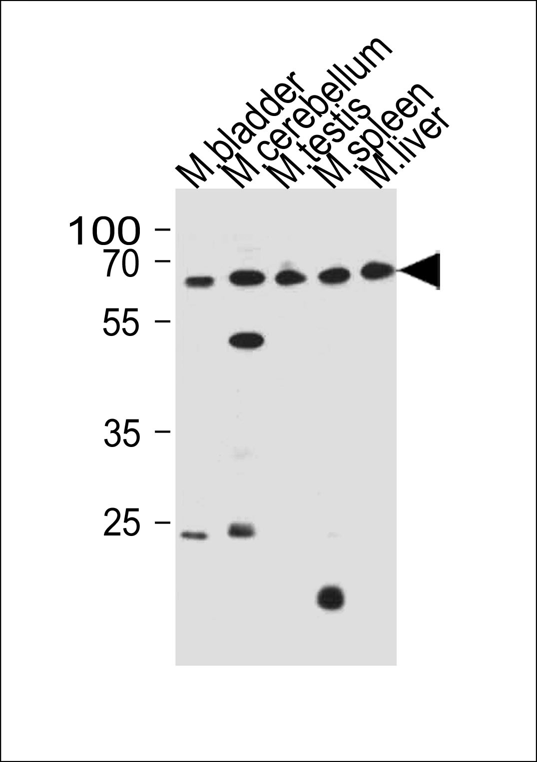 ZNF654 Antibody