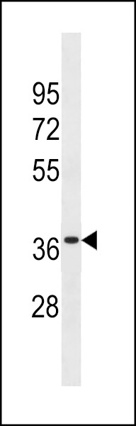 OR6K3 Antibody