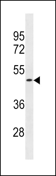 OR1S2 Antibody