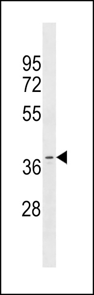OR11A1 Antibody
