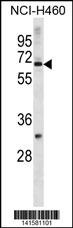 ZNF185 Antibody