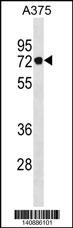 PODN Antibody