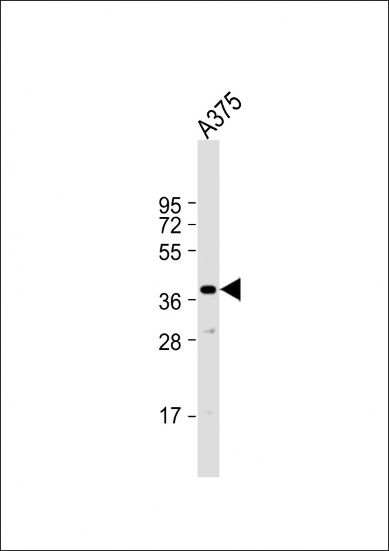 PIH1D1 Antibody