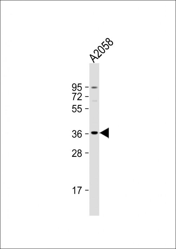 OR52J3 Antibody