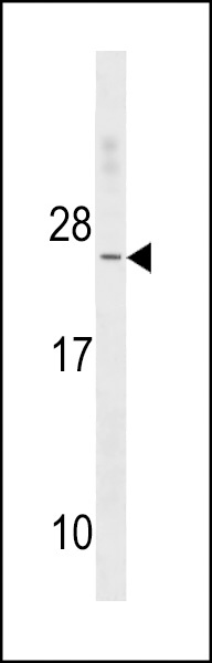 TNNC2 Antibody