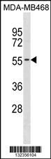 KCNK6 Antibody