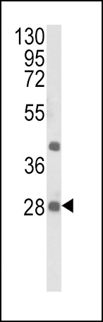 EIF4E2 Antibody