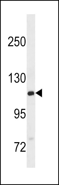 GTF2IRD2B Antibody