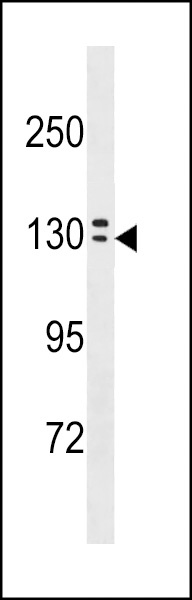 OVCH1 Antibody