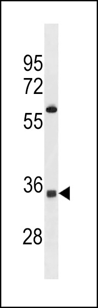 OR52A5 Antibody
