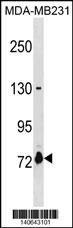 ASNSD1 Antibody