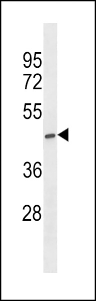 ST6GALNAC5 Antibody