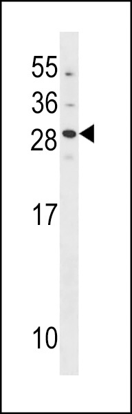 GUCA1B Antibody