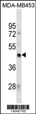 PDCD2L Antibody