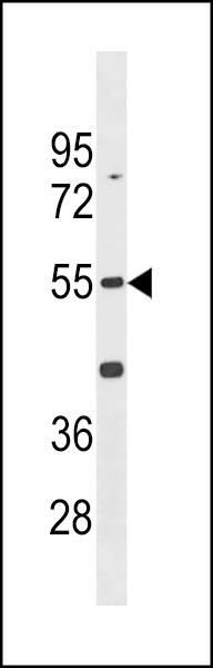 Cdk14 Antibody