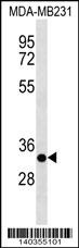 CAPNS2 Antibody