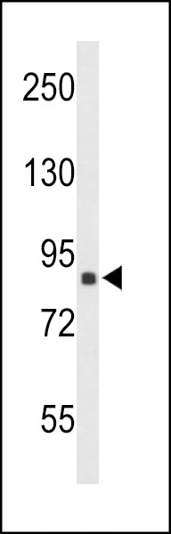 TNPO1 Antibody