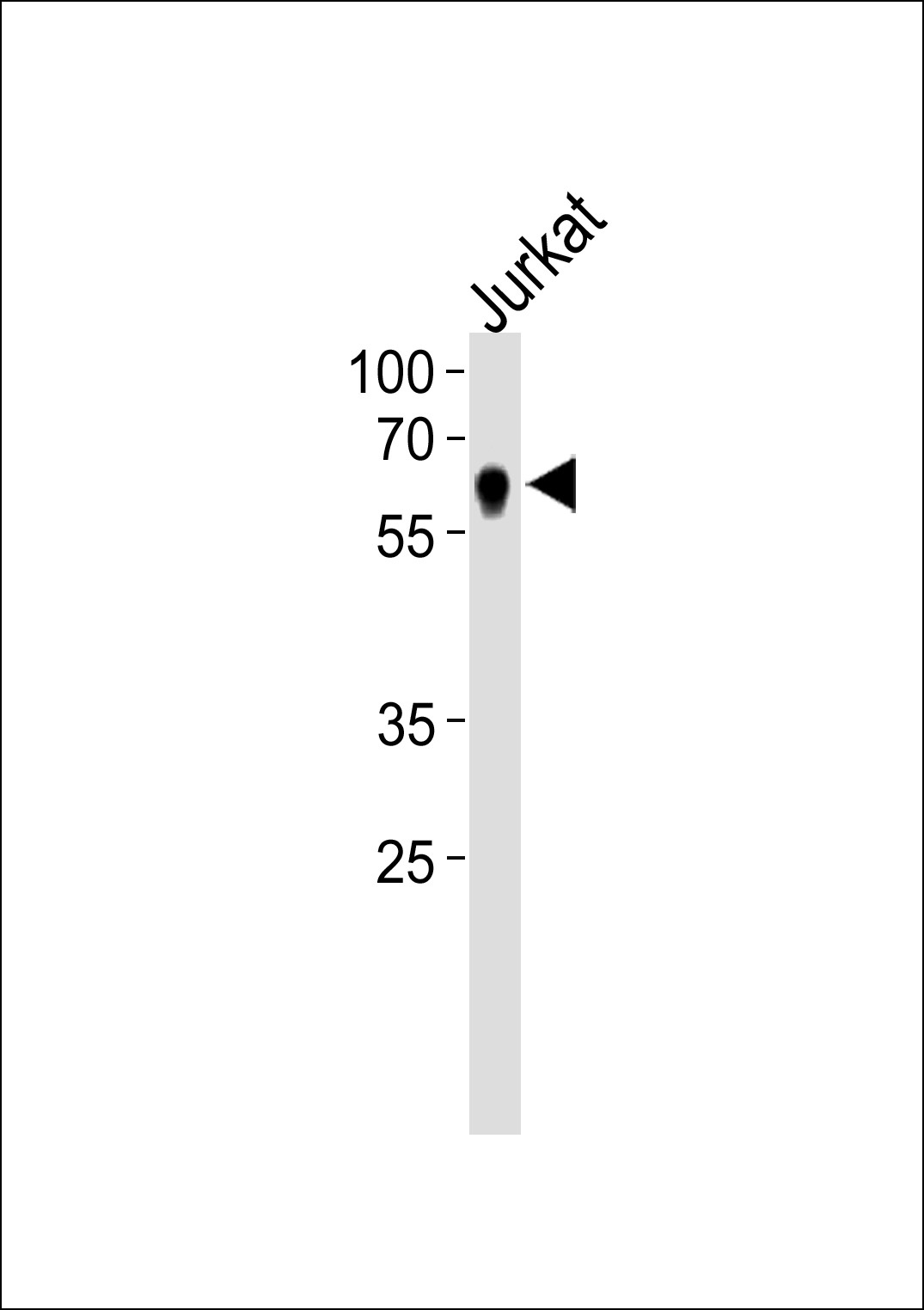 NR2C2 Antibody