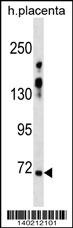 ZNF251 Antibody