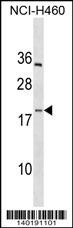 PF4V1 Antibody