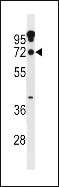 ZNF805 Antibody