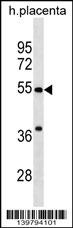 CHST2 Antibody