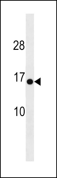 HIGD1C Antibody