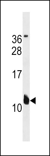 KCNE2 Antibody