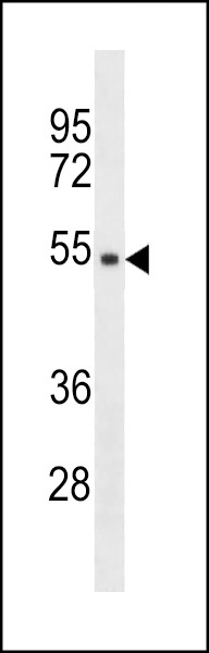 TMPPE Antibody