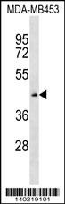 ZNF701 Antibody