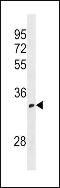 OR52I1 Antibody