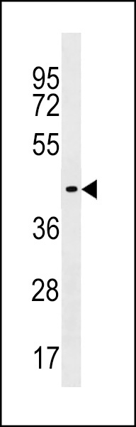 ZNF662 Antibody