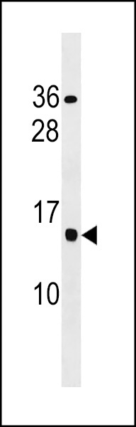 CCDC182 Antibody