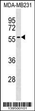 AKAP5 Antibody