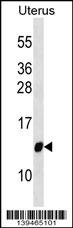 TIMM10 Antibody
